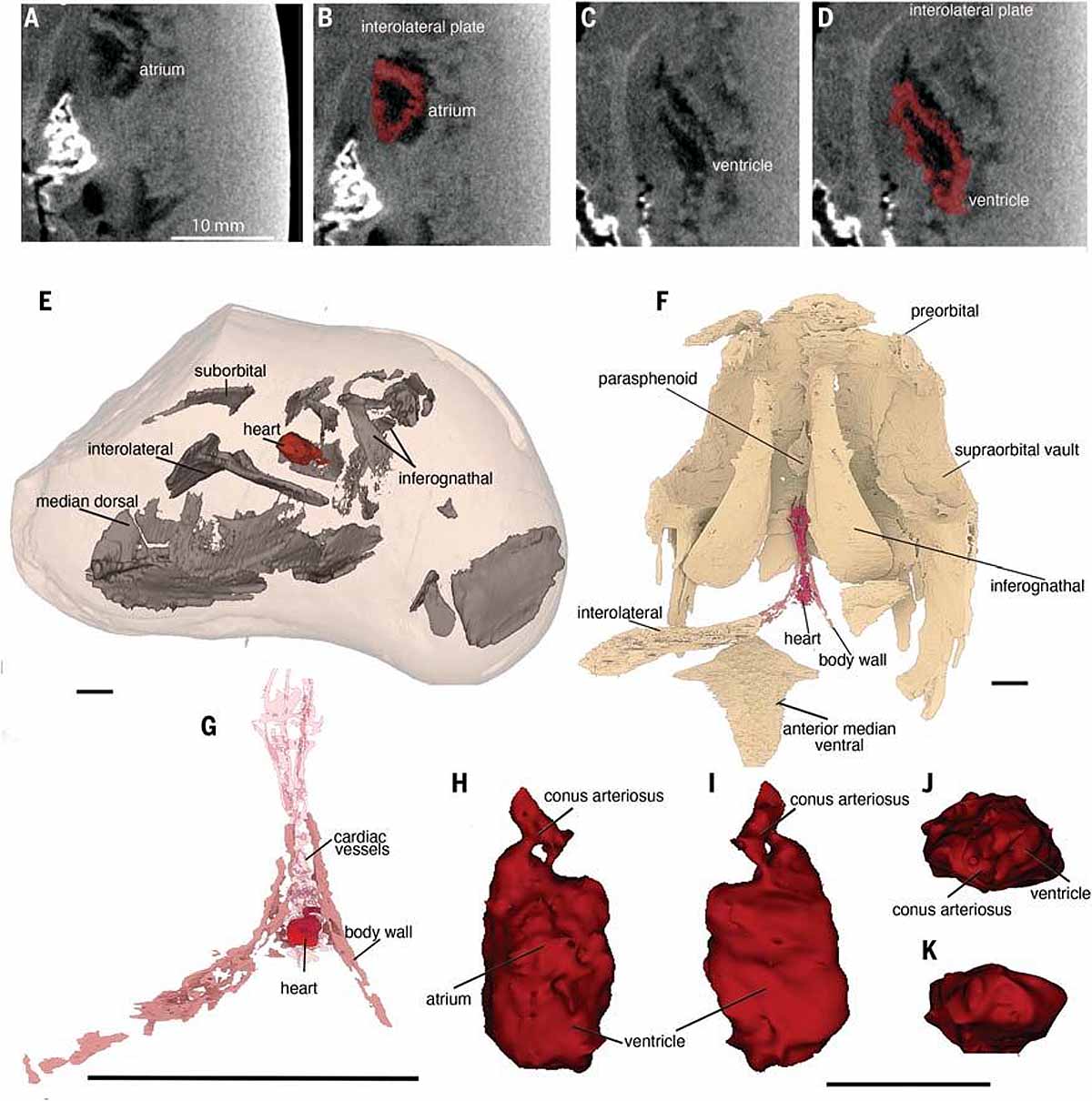 Oldest Heart arthrodire